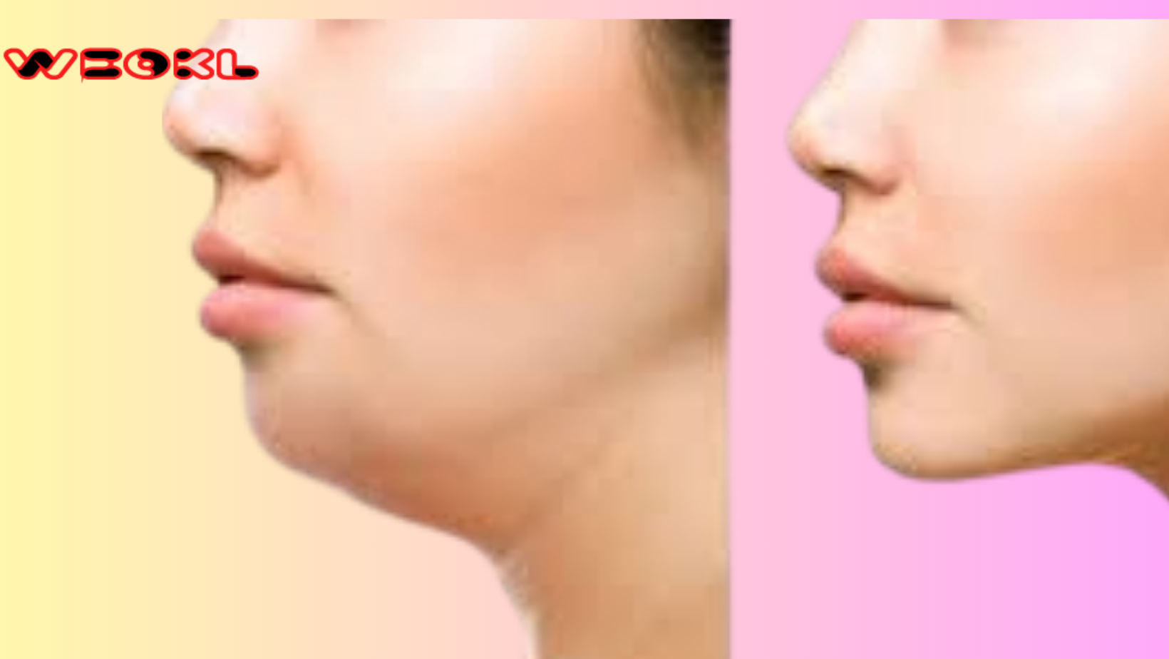 How To Get Rid of Neck Fat Under Chin Fast
