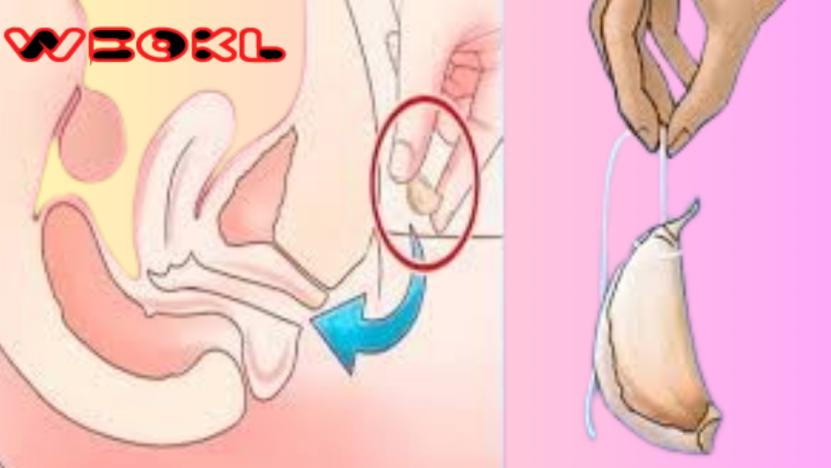 PUT A PIECE OF GARLIC IN THIS PART OF YOUR BODY