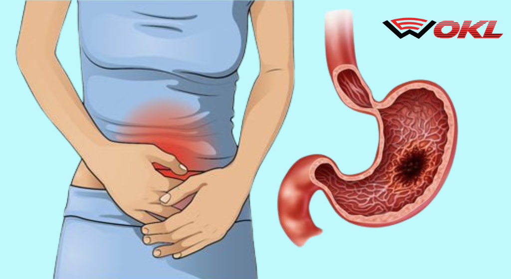 Stomach Cancer A Silent Killer — Most Common Symptoms (Don’t Ignore Them)