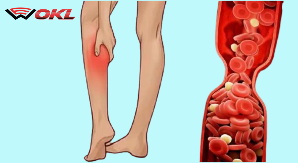 7 Warning Signs of Clogged Arteries